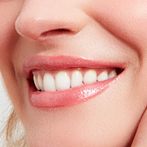 GLOSS - LE GLOSS BRILLANT ULTRA