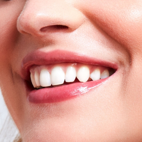 GLOSS - LE GLOSS BRILLANT ULTRA